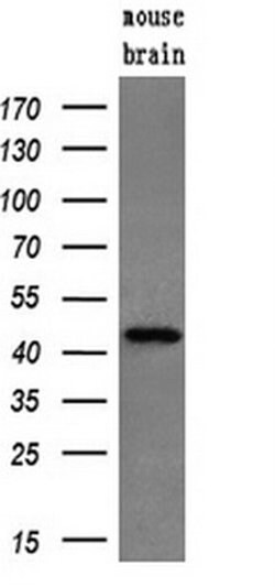 Invitrogen PPME1 Monoclonal Antibody (OTI10B2) 100 &mu;L; Unconjugated:Antibodies,