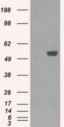 Invitrogen PFKFB4 Monoclonal Antibody (OTI1C8) 100 &mu;L | Buy Online | Invitrogen&trade; | Fisher Scientific