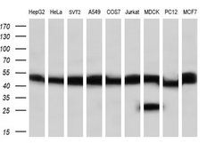 Invitrogen PPME1 Monoclonal Antibody (OTI7F12) 100 &mu;L; Unconjugated:Antibodies,