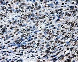 Invitrogen LOX Monoclonal Antibody (OTI9G6) 100 &mu;L; Unconjugated:Antibodies,