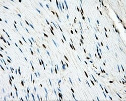 Invitrogen LOX Monoclonal Antibody (OTI9G6) 100 &mu;L; Unconjugated:Antibodies,