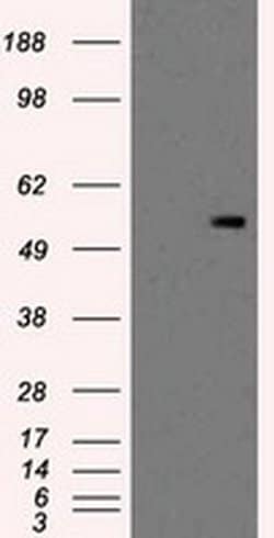 Invitrogen PKMYT1 Monoclonal Antibody (OTI5E1) 100 &mu;L; Unconjugated:Antibodies,