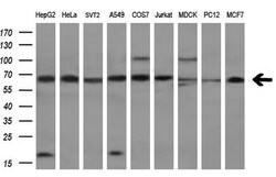 Invitrogen Transketolase Monoclonal Antibody (OTI5H3) 100 &mu;L | Buy Online | Invitrogen&trade; | Fisher Scientific