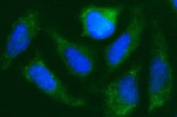 Invitrogen CISD1 Monoclonal Antibody (OTI2B3) 100 &mu;L; Unconjugated:Antibodies,