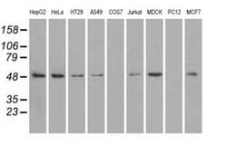 Invitrogen PSMC3 Monoclonal Antibody (OTI9F3) 100 &mu;L | Buy Online | Invitrogen&trade; | Fisher Scientific