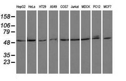Invitrogen PSMC3 Monoclonal Antibody (OTI1C10) 100 &mu;L; Unconjugated:Antibodies,