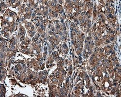 Invitrogen IFIT1 Monoclonal Antibody (OTI3G8) 100 &mu;L; Unconjugated:Antibodies,