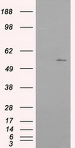 Invitrogen IFIT1 Monoclonal Antibody (OTI3G8) 100 &mu;L; Unconjugated:Antibodies,