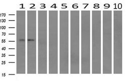 Invitrogen IFIT1 Monoclonal Antibody (OTI3G8) 100 &mu;L; Unconjugated:Antibodies,