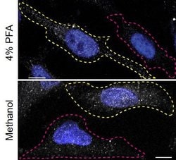 Invitrogen Annexin A11 Monoclonal Antibody (OTI1C6) 100 &mu;L; Unconjugated:Antibodies,