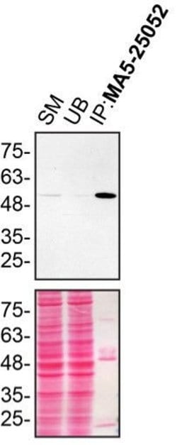Invitrogen Annexin A11 Monoclonal Antibody (OTI1C6) 100 &mu;L; Unconjugated:Antibodies,
