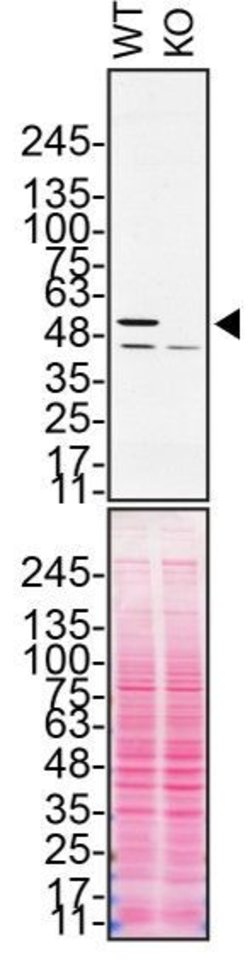 Invitrogen Annexin A11 Monoclonal Antibody (OTI1C6) 100 &mu;L; Unconjugated:Antibodies,