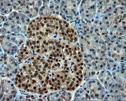 CUGBP1 Monoclonal Antibody (OTI5B8):Antibodies, Monoclonal