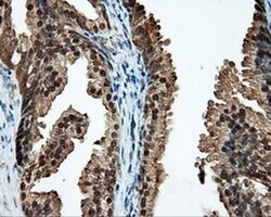 CUGBP1 Monoclonal Antibody (OTI5B8):Antibodies, Monoclonal