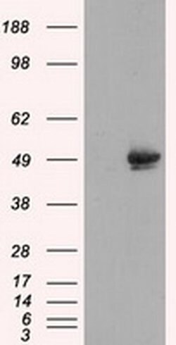 CUGBP1 Monoclonal Antibody (OTI5B8):Antibodies, Monoclonal