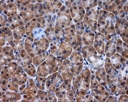 Invitrogen KIAA1609 Monoclonal Antibody (OTI3C4) 100 &mu;L | Buy Online | Invitrogen&trade; | Fisher Scientific