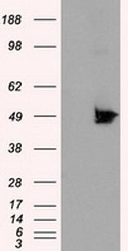 Invitrogen KIAA1609 Monoclonal Antibody (OTI3C4) 100 &mu;L | Buy Online | Invitrogen&trade; | Fisher Scientific