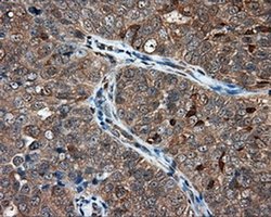 Invitrogen NIT1 Monoclonal Antibody (OTI4D12) 100 &mu;L; Unconjugated:Antibodies,