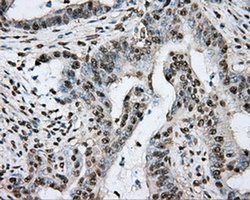 Invitrogen PTPRE Monoclonal Antibody (OTI3D4) 100 &mu;L; Unconjugated:Antibodies,