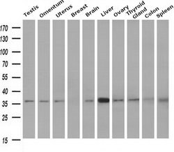 Invitrogen NIT1 Monoclonal Antibody (OTI3A11) 100 &mu;L; Unconjugated:Antibodies,