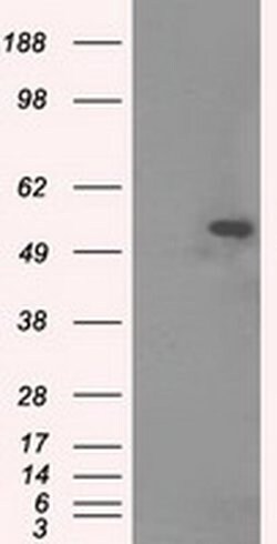 Invitrogen TUBA8 Monoclonal Antibody (OTI2G6) 100 &mu;L; Unconjugated:Antibodies,