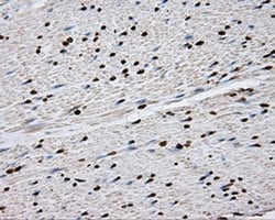 Invitrogen DAPK2 Monoclonal Antibody (OTI1C5) 100 &mu;L; Unconjugated:Antibodies,