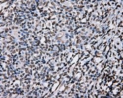 Invitrogen DAPK2 Monoclonal Antibody (OTI1C5) 100 &mu;L; Unconjugated:Antibodies,