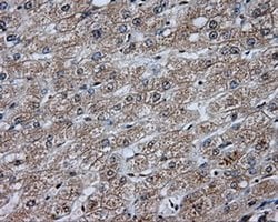 Invitrogen DAPK2 Monoclonal Antibody (OTI1C5) 100 &mu;L; Unconjugated:Antibodies,