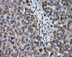 Invitrogen DAPK2 Monoclonal Antibody (OTI1C5) 100 &mu;L; Unconjugated:Antibodies,