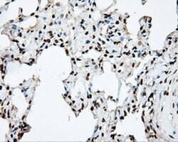 Invitrogen DAPK2 Monoclonal Antibody (OTI1C5) 100 &mu;L; Unconjugated:Antibodies,