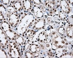 Invitrogen DAPK2 Monoclonal Antibody (OTI1C5) 100 &mu;L; Unconjugated:Antibodies,