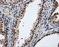 Invitrogen DAPK2 Monoclonal Antibody (OTI1C5) 100 &mu;L; Unconjugated:Antibodies,