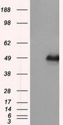 Invitrogen DAPK2 Monoclonal Antibody (OTI1C5) 100 &mu;L; Unconjugated:Antibodies,