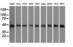 Invitrogen DAPK2 Monoclonal Antibody (OTI1C5) 100 &mu;L; Unconjugated:Antibodies,