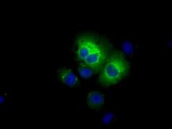 Invitrogen ALDH3A1 Monoclonal Antibody (OTI1B6) 100 &mu;L; Unconjugated:Antibodies,