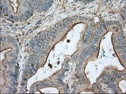 Invitrogen ALDH3A1 Monoclonal Antibody (OTI1B6) 100 &mu;L; Unconjugated:Antibodies,