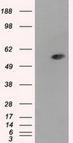 Invitrogen ALDH3A1 Monoclonal Antibody (OTI1B6) 100 &mu;L; Unconjugated:Antibodies,