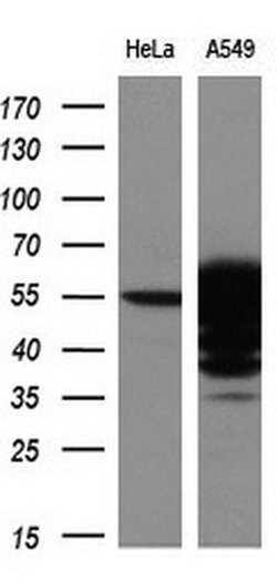 Invitrogen ALDH3A1 Monoclonal Antibody (OTI1B6) 100 &mu;L; Unconjugated:Antibodies,