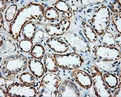 Invitrogen NME4 Monoclonal Antibody (OTI5E4) 100 &mu;L; Unconjugated:Antibodies,