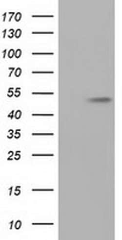 Invitrogen TUBA8 Monoclonal Antibody (OTI2C2) 100 &mu;L; Unconjugated:Antibodies,