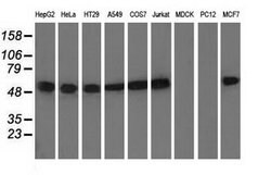 Invitrogen TUBA8 Monoclonal Antibody (OTI2C2) 100 &mu;L; Unconjugated:Antibodies,