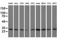 Invitrogen CAPZA1 Monoclonal Antibody (OTI7C8) 100 &mu;L | Buy Online | Invitrogen&trade; | Fisher Scientific