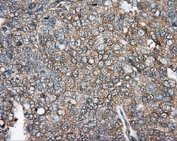 Invitrogen DNTTIP1 Monoclonal Antibody (OTI1F4) 100 &mu;L; Unconjugated:Antibodies,