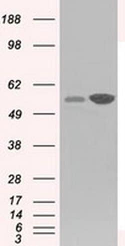 Invitrogen GPI Monoclonal Antibody (OTI5A11) 100 &mu;L; Unconjugated:Antibodies,