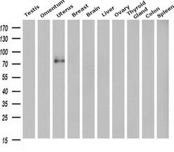 Invitrogen H-cadherin Monoclonal Antibody (OTI3H6) 100 &mu;L; Unconjugated:Antibodies,