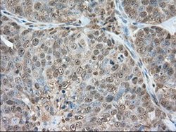 Invitrogen GPI Monoclonal Antibody (OTI2D2) 100 &mu;L | Buy Online | Invitrogen&trade; | Fisher Scientific