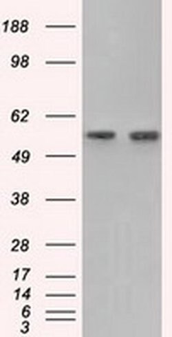 Invitrogen GPI Monoclonal Antibody (OTI2D2) 100 &mu;L | Buy Online | Invitrogen&trade; | Fisher Scientific