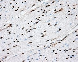 Invitrogen ACSBG1 Monoclonal Antibody (OTI2B6) 100 &mu;L | Buy Online | Invitrogen&trade; | Fisher Scientific