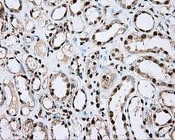 Invitrogen ACSBG1 Monoclonal Antibody (OTI2B6) 100 &mu;L | Buy Online | Invitrogen&trade; | Fisher Scientific