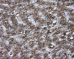 Invitrogen ACSBG1 Monoclonal Antibody (OTI2B6) 100 &mu;L | Buy Online | Invitrogen&trade; | Fisher Scientific